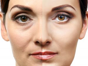 Side by side comparison of cosmetic procedure