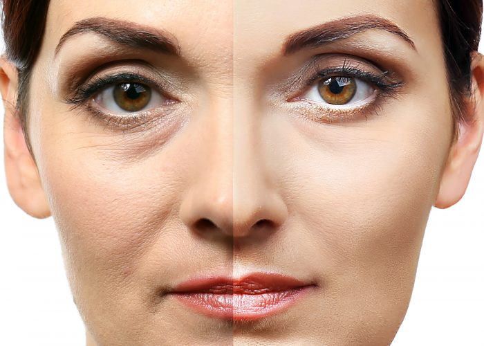 Side by side comparison of cosmetic procedure
